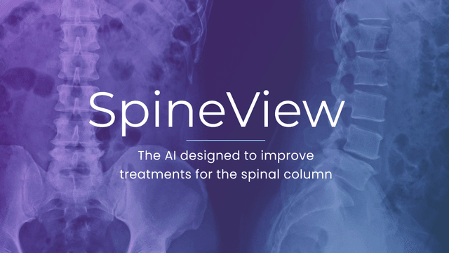 SpineView